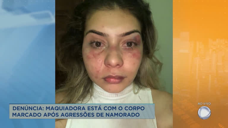 Vídeo: Maquiadora de Itabira (MG) denuncia agressões do ex-namorado