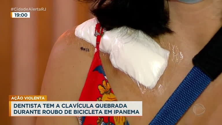 Vídeo: Mulher passa por cirurgia após ter bicicleta roubada em Ipanema